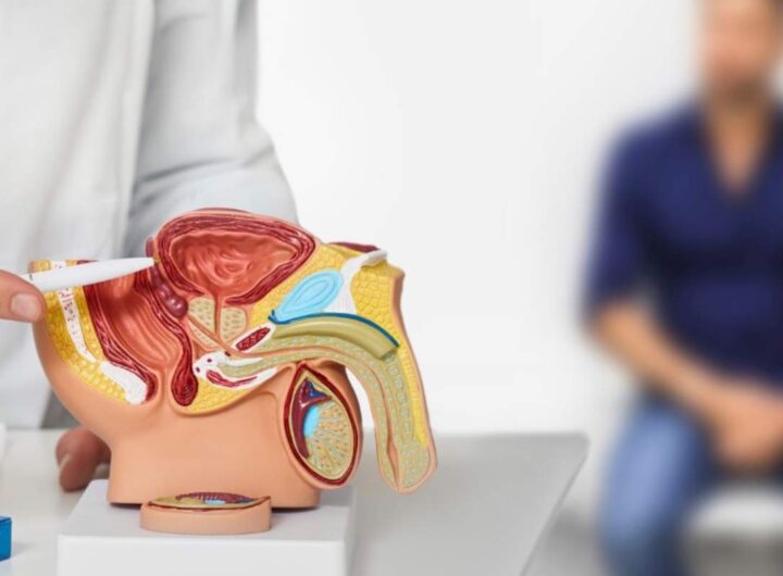 Scoperta tumore alla prostata