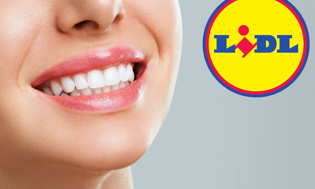 Ho detto addio al dentista, tutto grazie a...Lidl