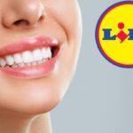 Ho detto addio al dentista, tutto grazie a...Lidl