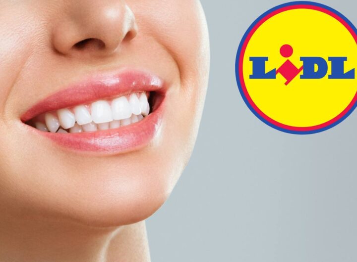 Ho detto addio al dentista, tutto grazie a...Lidl