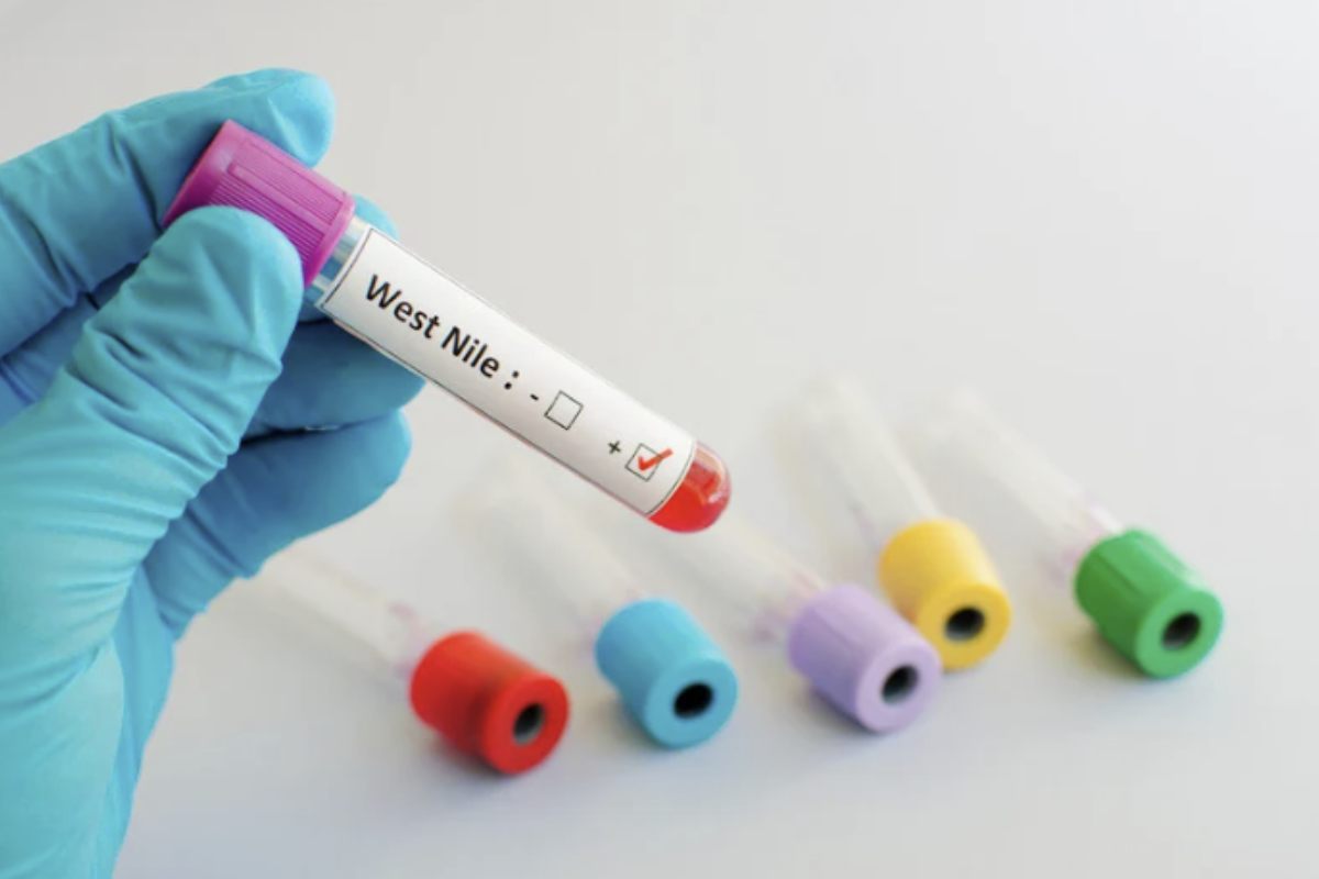 In assenza di un vaccino specifico contro il virus West Nile, l’attenzione si concentra su strategie di prevenzione volte a limitare