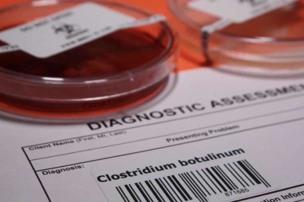In questo articolo approfondiremo l’aspetto della sicurezza alimentare legata al botulino, analizzando i rischi di contaminazione,