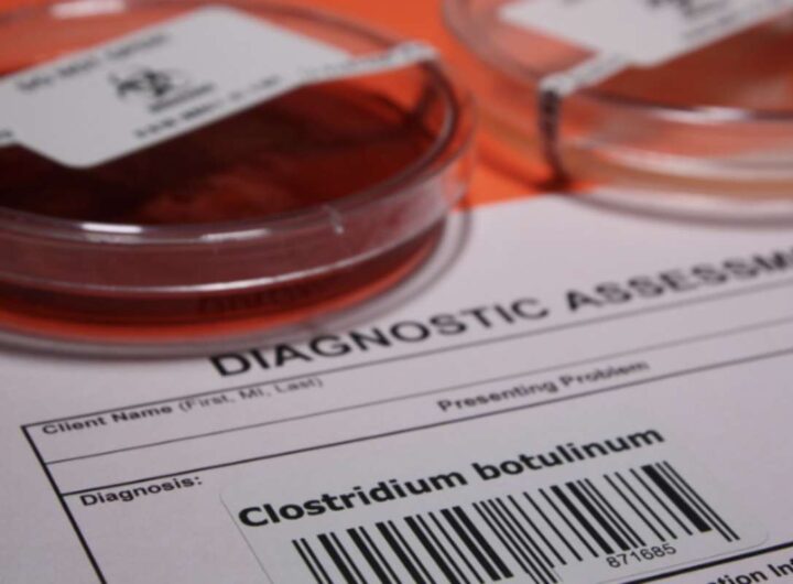 In questo articolo approfondiremo l’aspetto della sicurezza alimentare legata al botulino, analizzando i rischi di contaminazione,