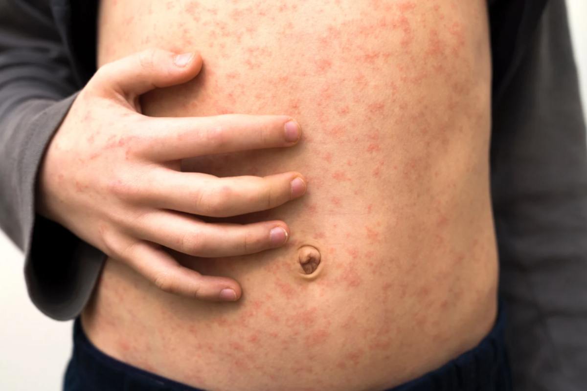 Virus mortale