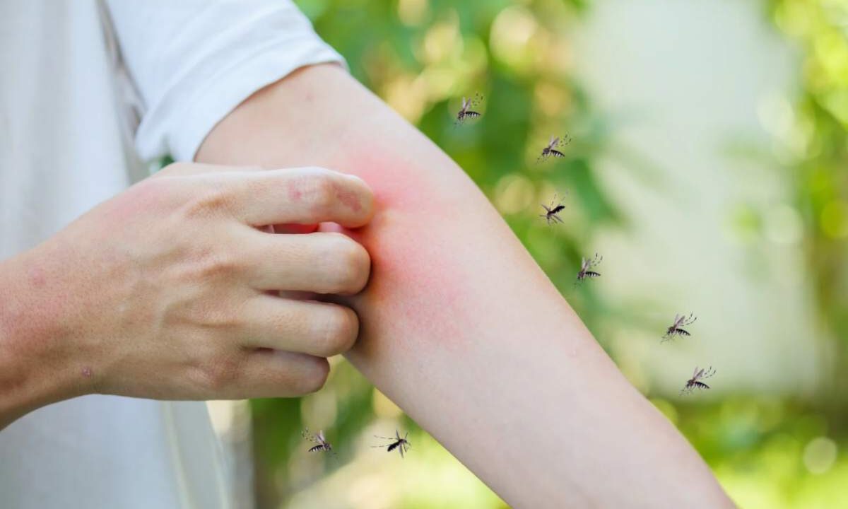 West Nile