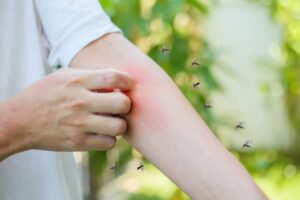West Nile