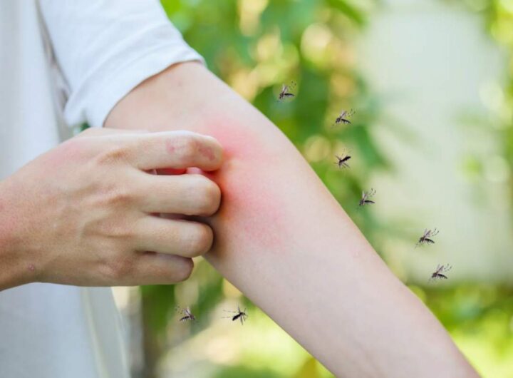 West Nile